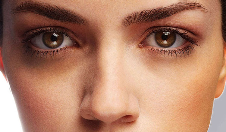 How To Remove Dark Circles From Under Eyes Permanently